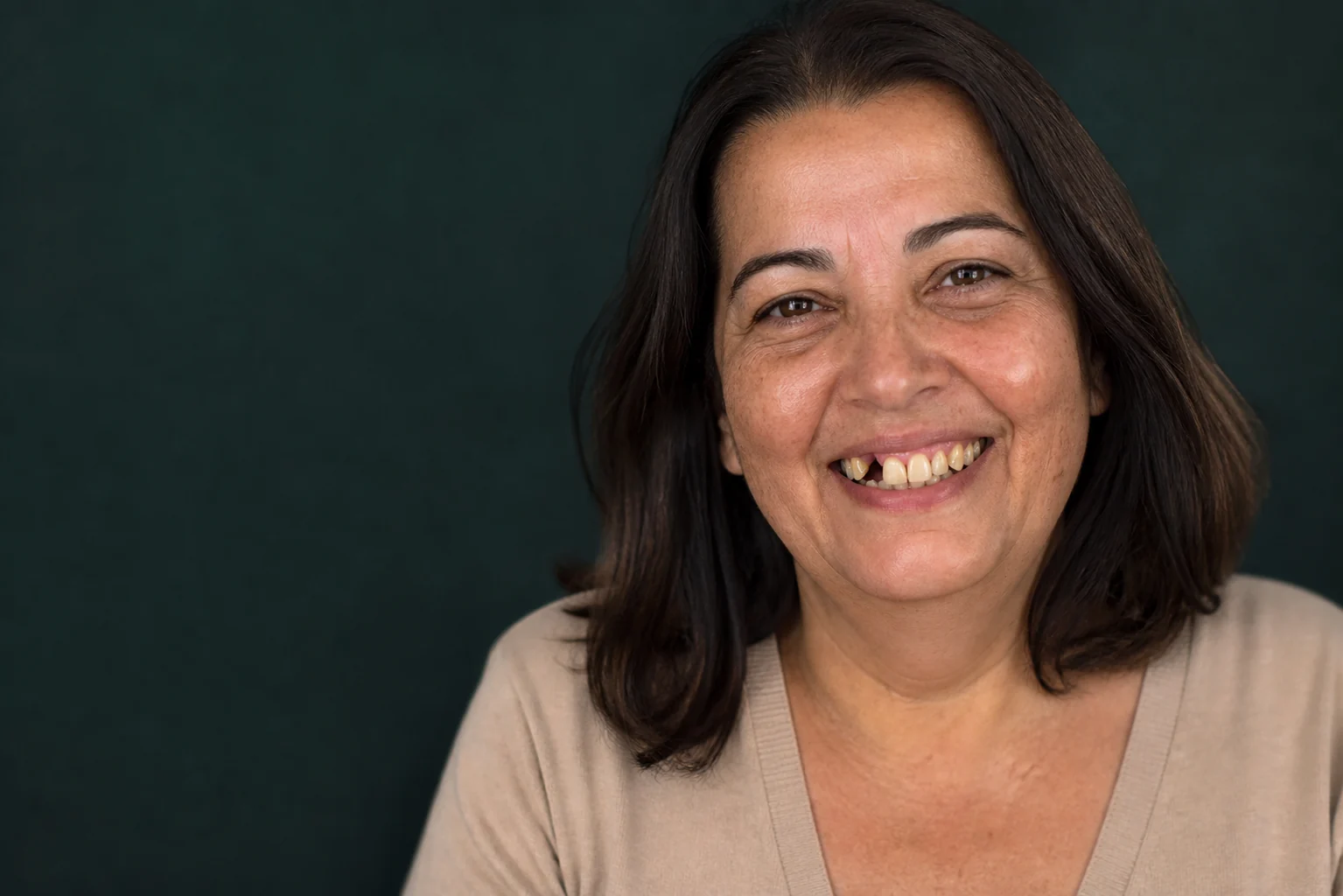 A mesma pessoa antes, com os dentes desgastados e escurecidos